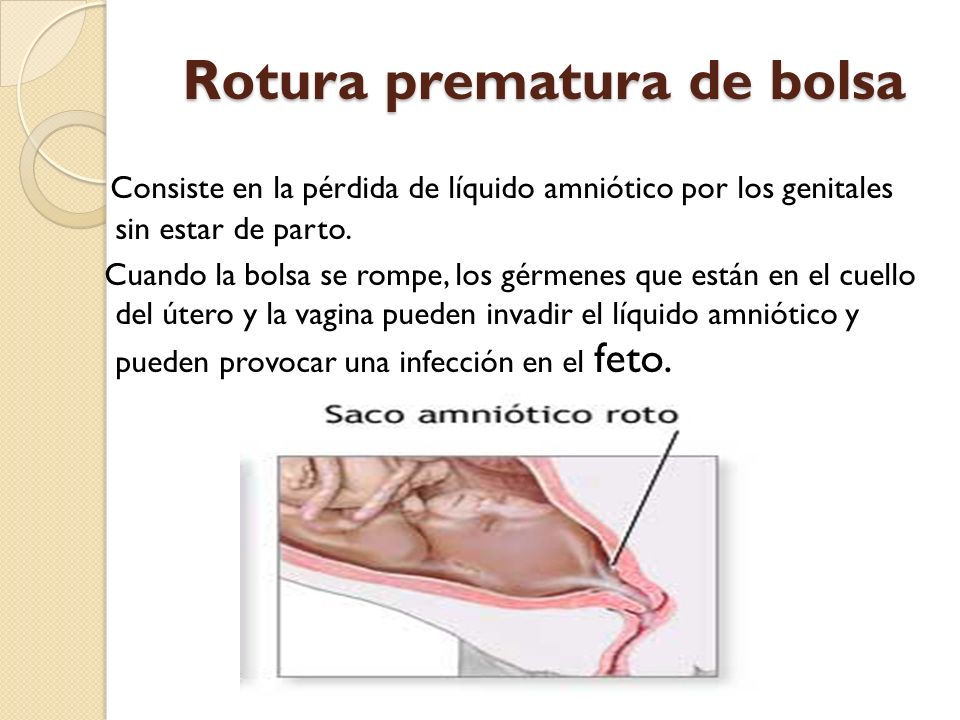 perdida de liquido amniotico en el tercer trimestre perdida de liquido amniotico en el tercer trimestre